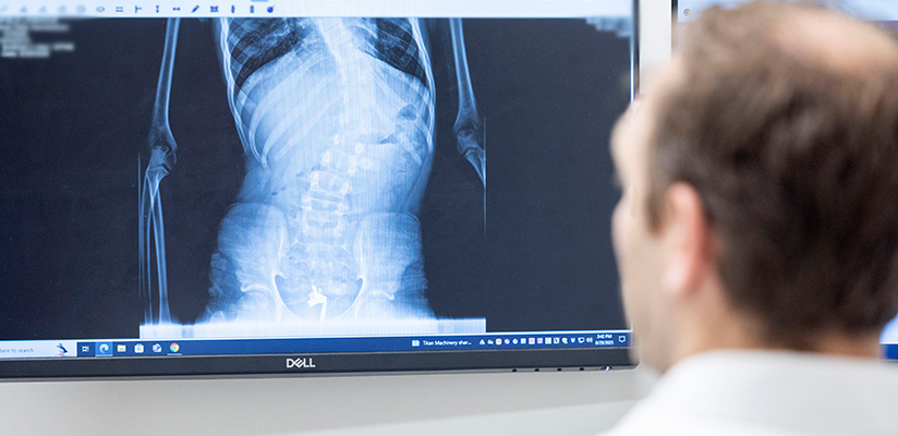 Spine3Blur_2025 copy.jpg